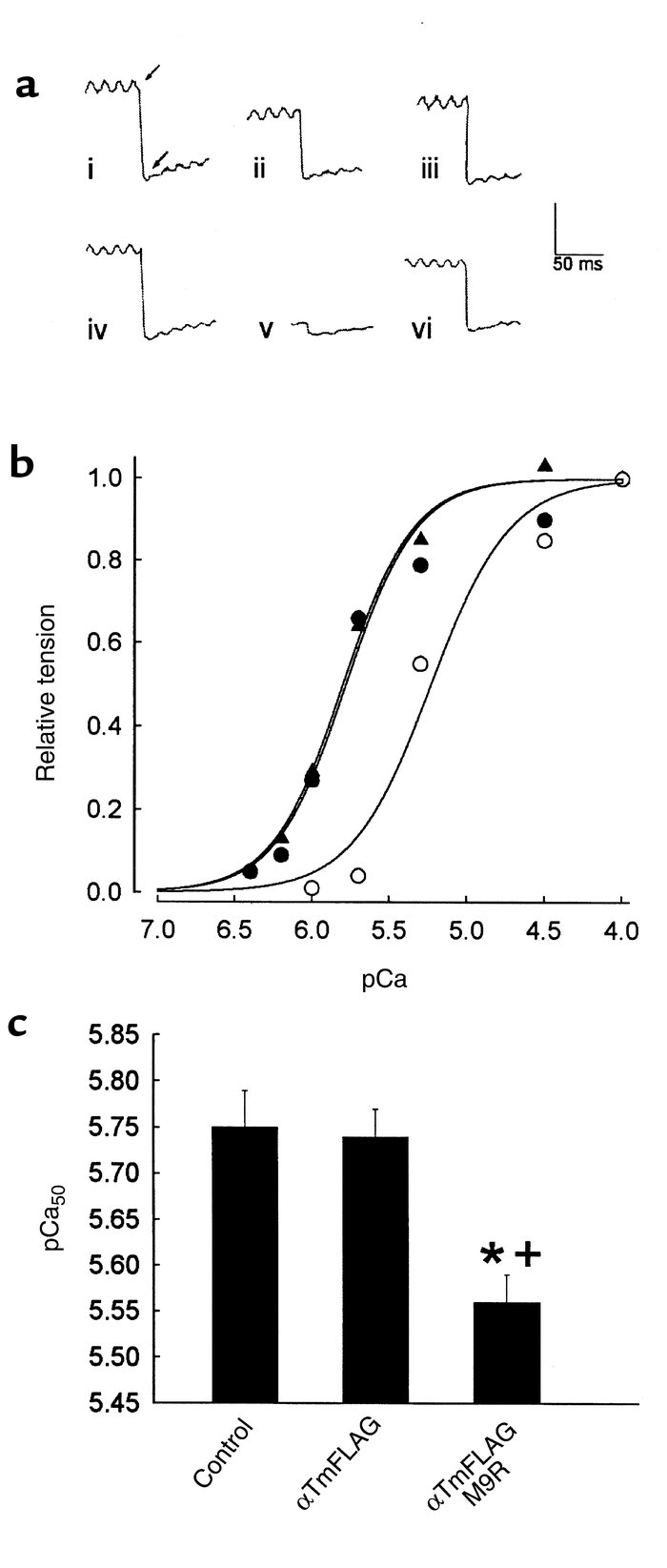 Steady-state isometric force production in adult myocytes expressing nor...