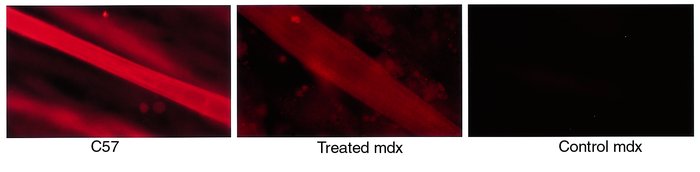 Immunohistochemistry of myotubes from primary cell culture from C57 and ...