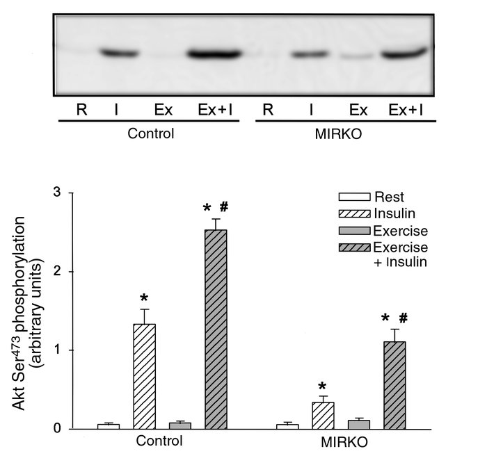 Akt Ser473 phosphorylation. Akt Ser473 phosphorylation was identified by...