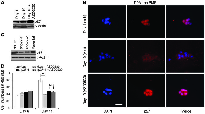 AZD0530 mediated inhibition of the spontaneous proliferative switch is a...