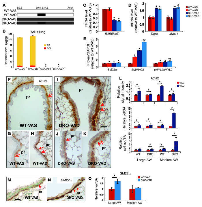 Consequences of prenatal VAD in the SM phenotype of the adult lung.
(A) ...