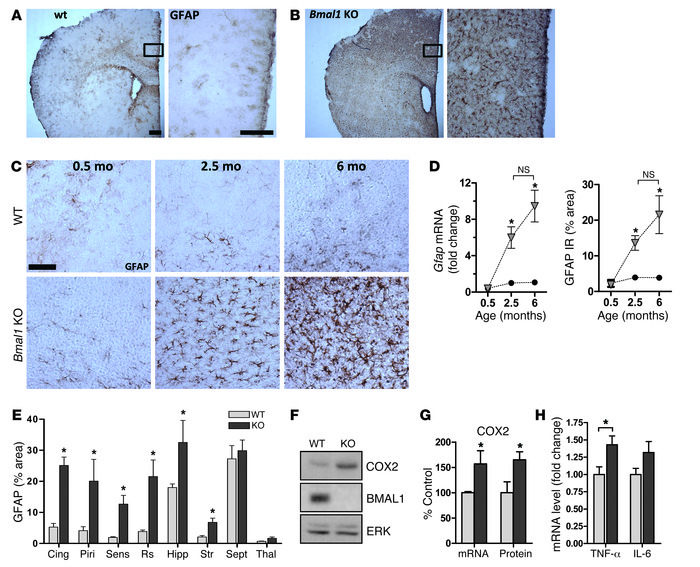 Marked age-dependent cerebral astroglial activation in Bmal1 KO mice.
 
...