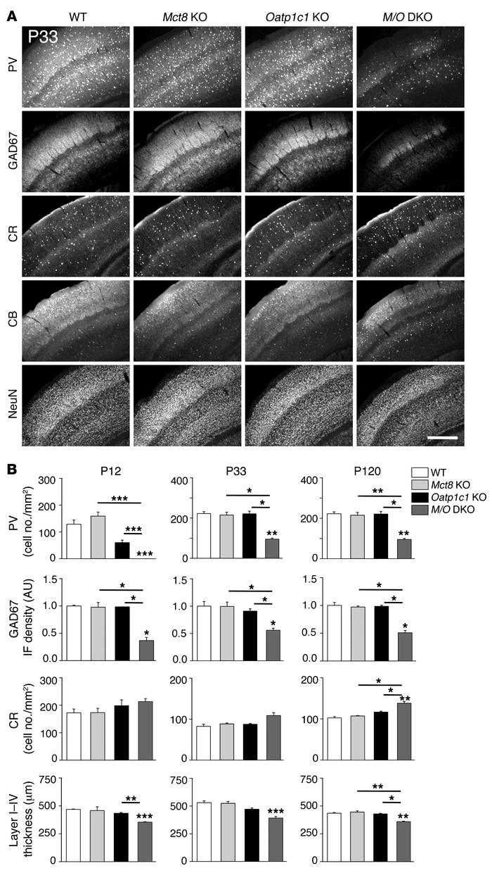 Histological analysis of GABAergic neurons in the somatosensory cortex.
...