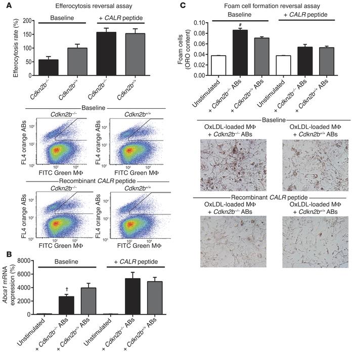 The Cdkn2b-dependent defect in efferocytosis is reversible.
 
(A) Applic...