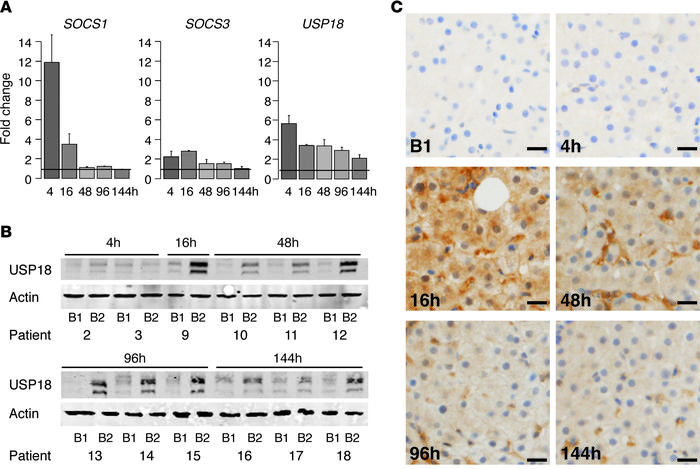 The negative regulator USP18 is continuously upregulated during the enti...