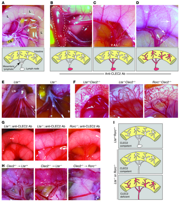 Blood enters lymphatic vessels of the intestine via backflow from mesent...