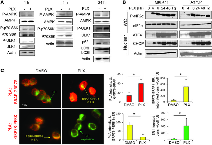 BRAFi induces an early ER stress response.
(A) Immunoblotting against th...