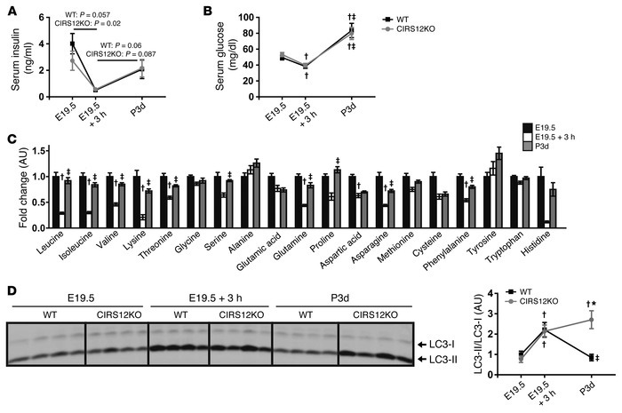 IRS signaling suppresses postnatal autophagy.
(A–D) Time course of (A) s...