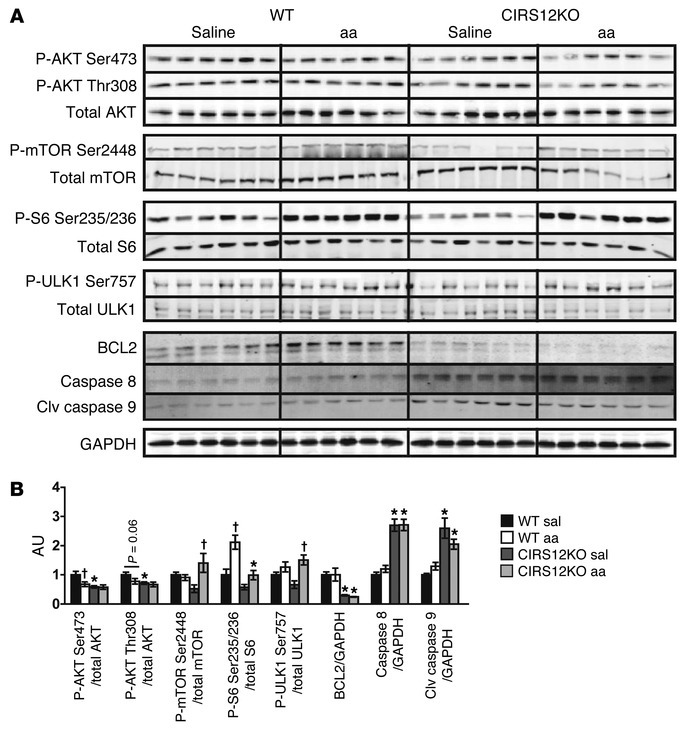 Increased proapoptotic signaling in CIRS12KO hearts persists after aa tr...