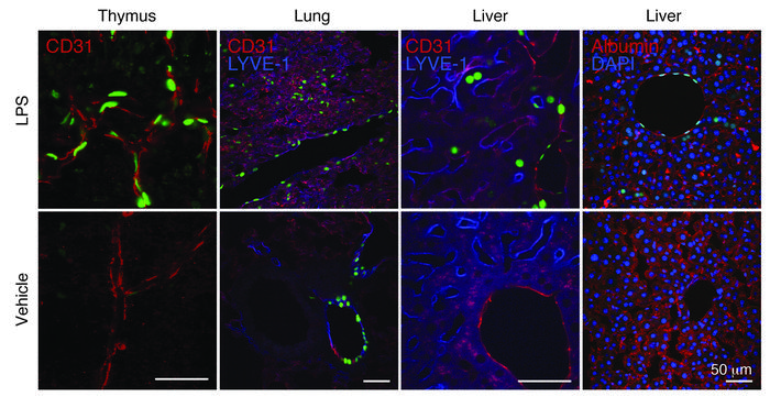 S1P1 activation in endothelial cells and hepatocytes during systemic inf...