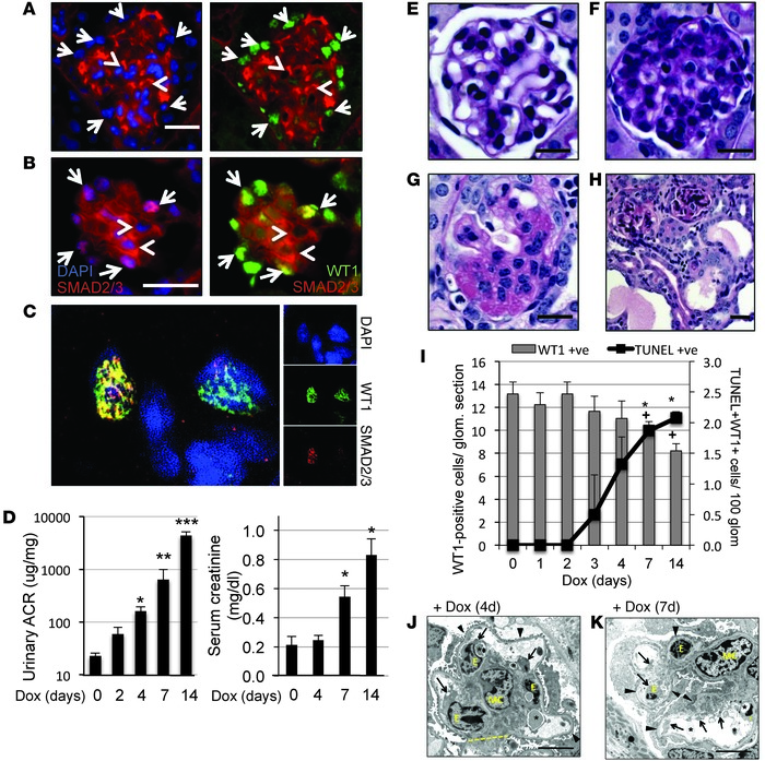 Activation of podocyte-specific TGFβR1 induces podocytopathy with progre...