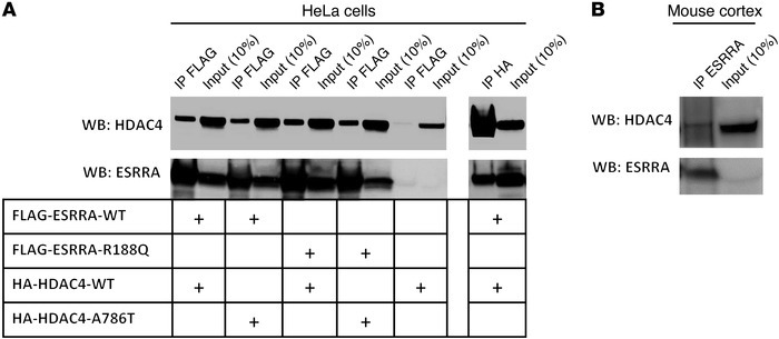 Interaction of ESRRA and HDAC4.
(A) Plasmids expressing wild-type or mut...