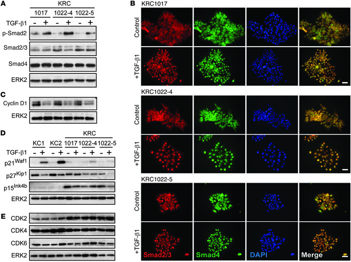 TGF-β1 enhances Smad2-4 nuclear translocation without inducing p21Waf1 i...