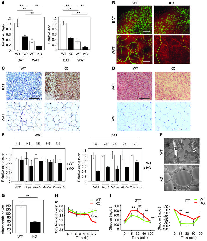 The whitening of BAT and impaired glucose metabolism in aP2-Cre+/– Vegfa...