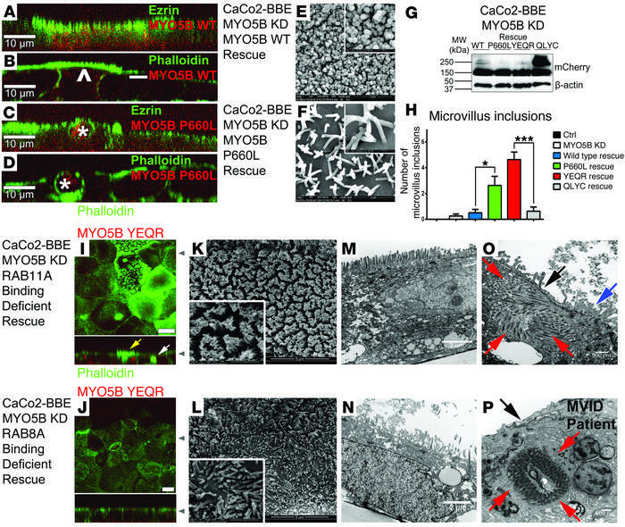 MYO5B-WT and MYO5B-YE/QR rescue the MYO5B-KD phenotype, while MYO5B-P660...