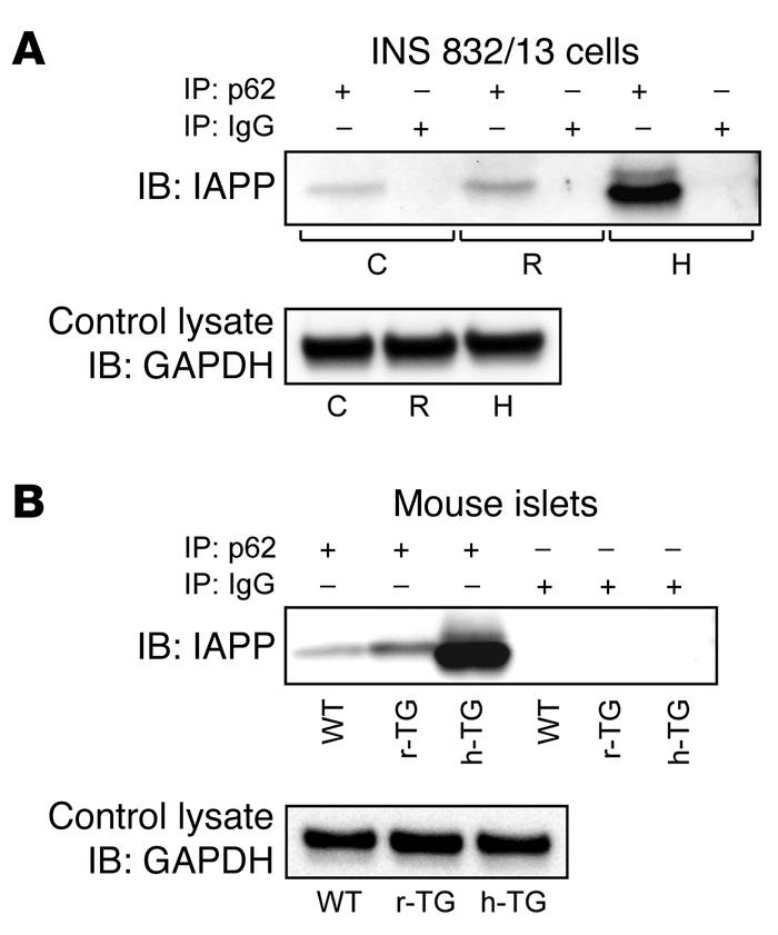 IAPP interacts with p62 in β cells.
(A) INS 832/13 cells were transduced...