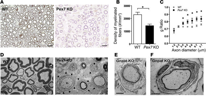 Deficiency in plasmalogens impairs the ability of Schwann cells to susta...
