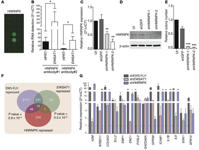 EWSAT1 interacts with HNRNPK to regulate gene expression.
(A) Image of p...