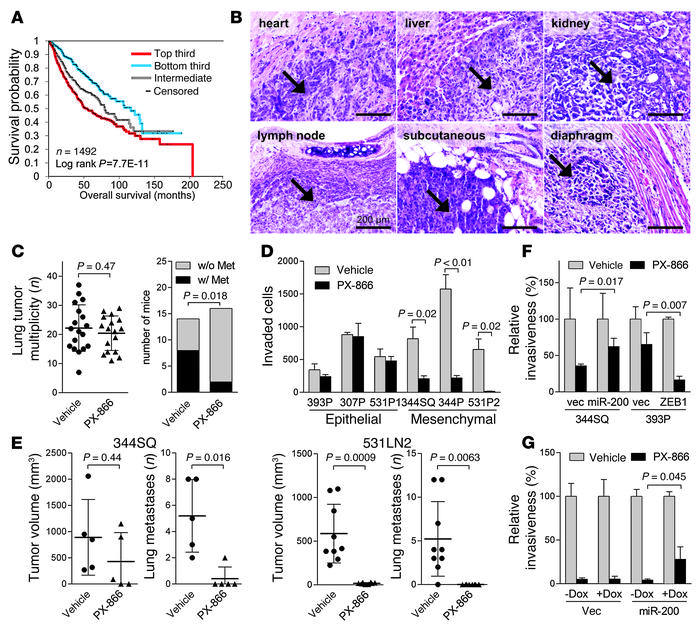 Mesenchymal lung adenocarcinoma cells are sensitive to PX-866.
(A) Survi...