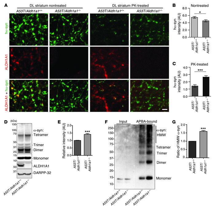 Genetic inhibition of Aldh1a1 promotes α-synuclein aggregation in A53T t...