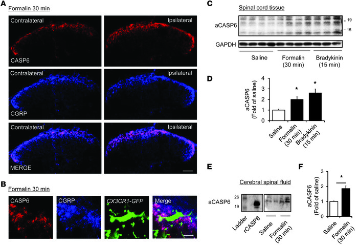 Upregulation of CASP6 in the spinal cord and CSF after acute inflammatio...