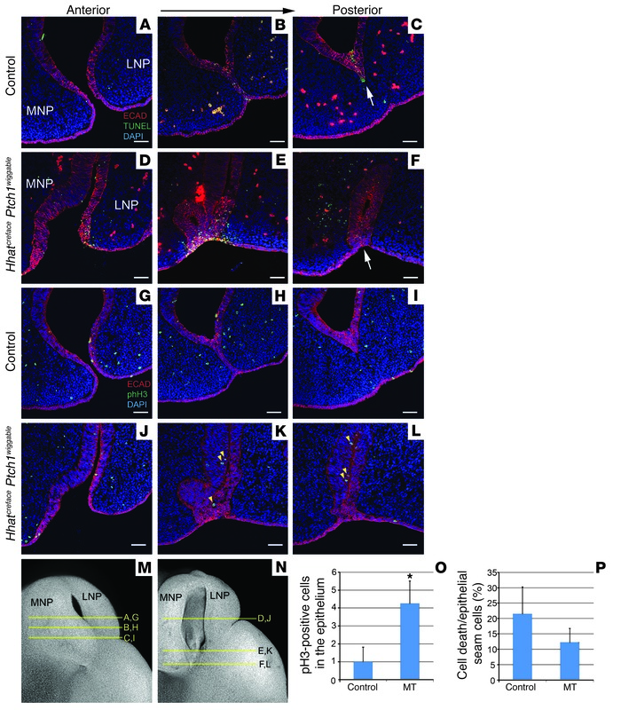 Cell death and proliferation in epithelial seams of E11.5 Hhatcreface Pt...