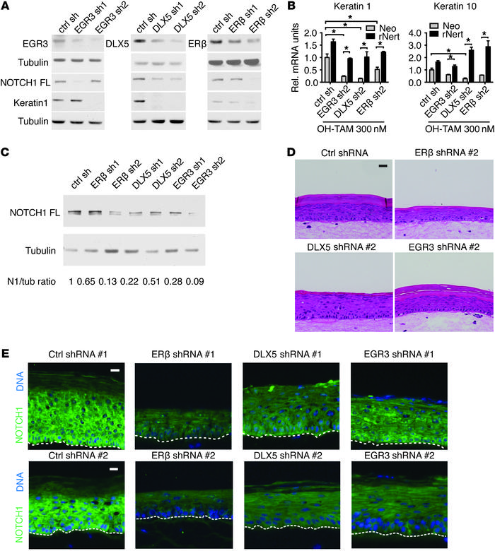 Silencing of EGR3, DLX5, and ERβ leads to attenuation of NOTCH1 expressi...