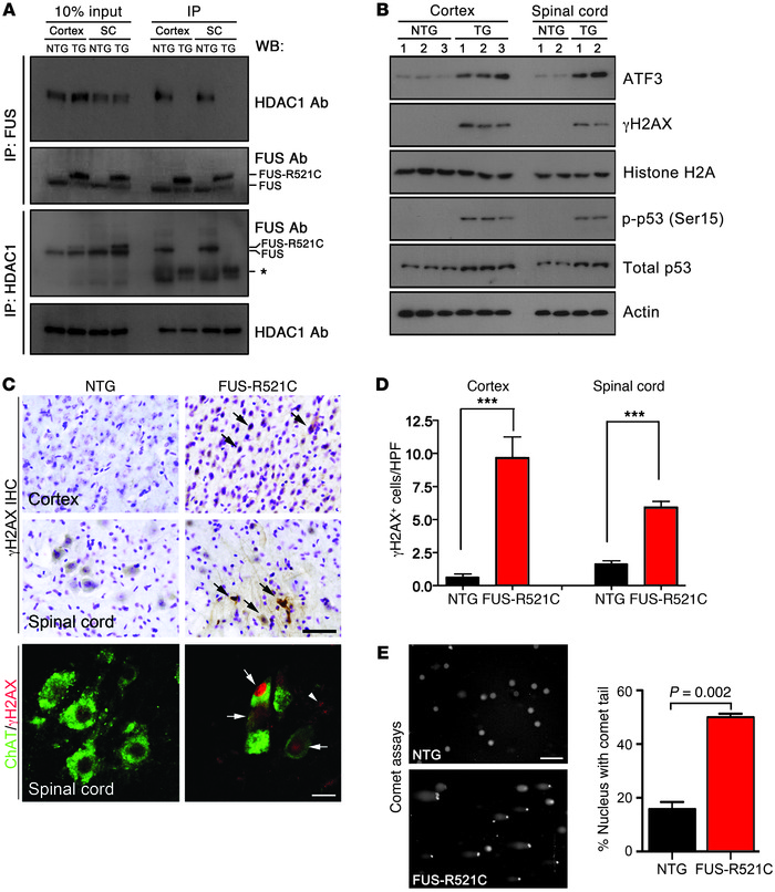 FUS-R521C transgenic mice exhibit an impairment of FUS/HDAC1 interaction...