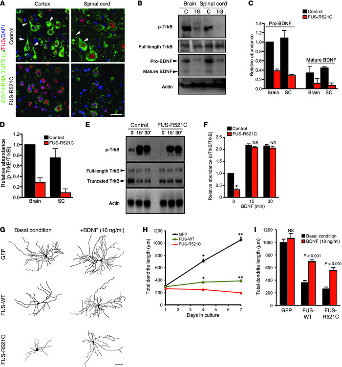 BDNF restores TrkB activation and partially ameliorates dendrite phenoty...