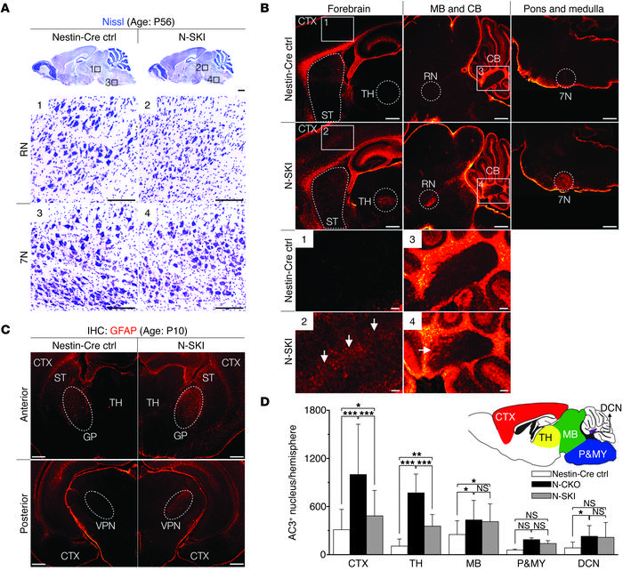 N-SKI mice exhibit sensorimotor circuit selective neurodegeneration.
(A)...