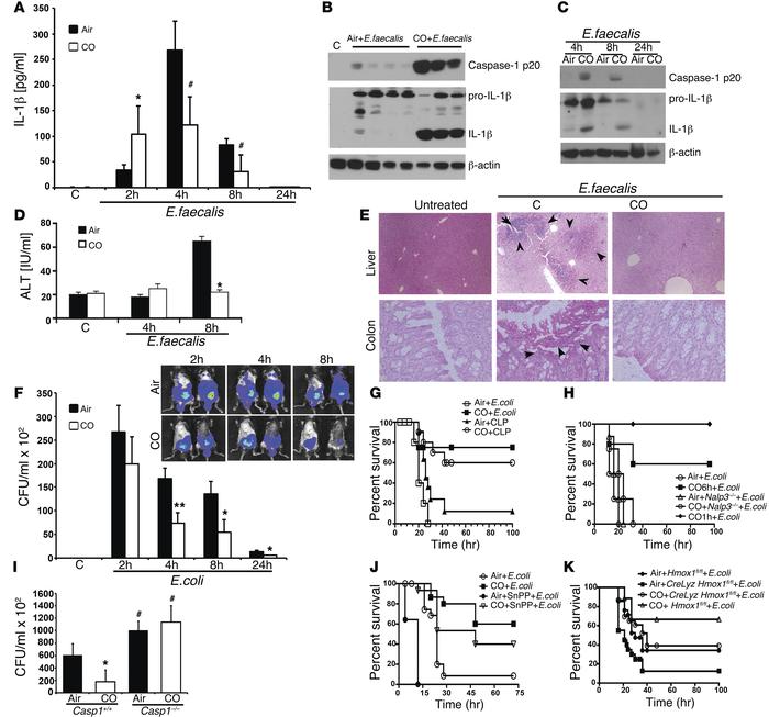 CO acts therapeutically to inhibit lethal sepsis via the inflammasome.
(...