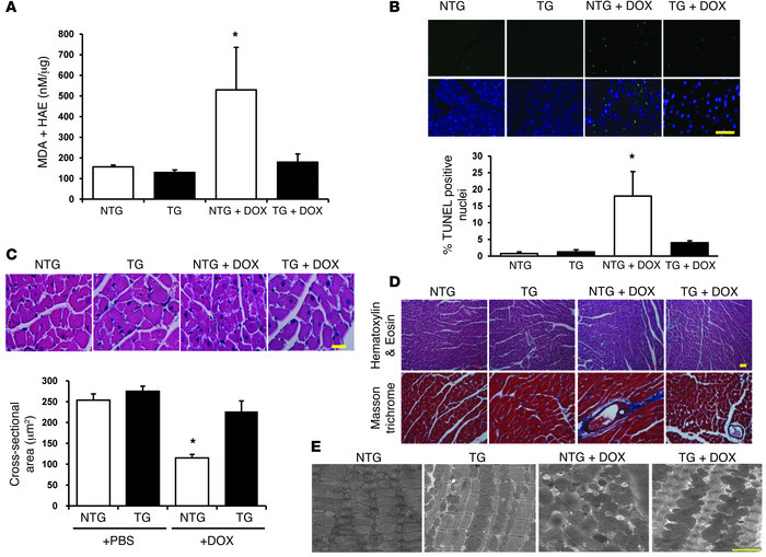 Hearts from ABCB8 TG mice display reductions in ROS and structural damag...