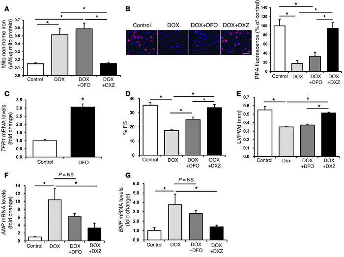 DXZ reduces mitochondrial iron and reverses the cardiotoxic effects of D...