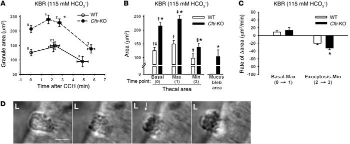 Dynamics of goblet cell exocytosis induced by 100 μM CCH in WT and Cftr-...