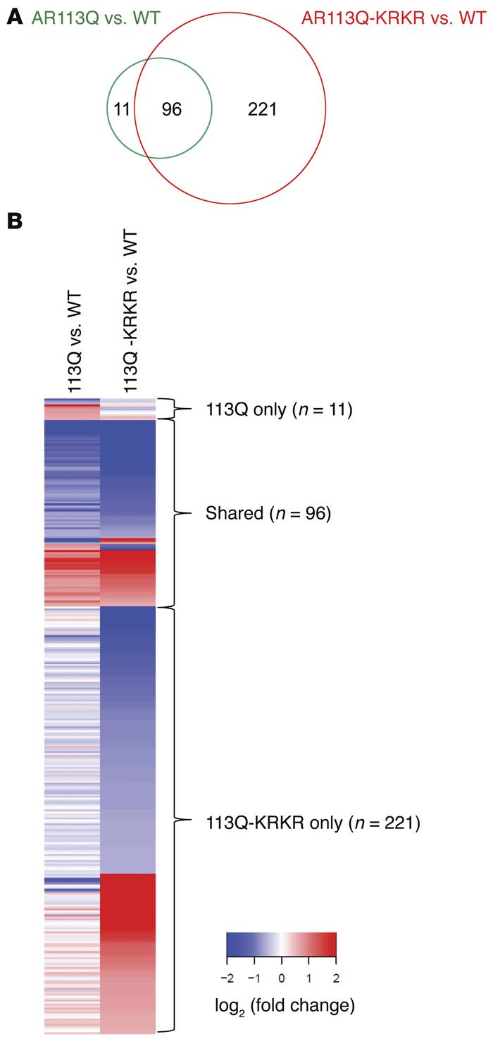 Gene-expression differences in quadriceps muscle of WT, AR113Q, and AR11...