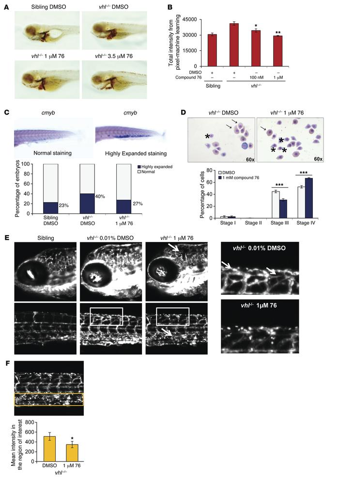 HIF2α inhibitor compound 76 rescues abnormal erythropoiesis and ameliora...