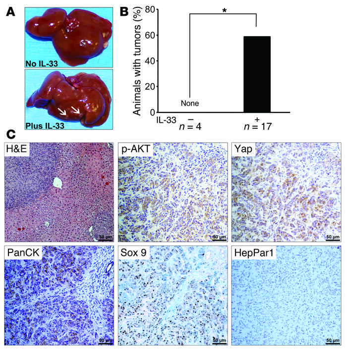 IL-33 facilitates biliary carcinogenesis.
(A) liver appearance of mice a...