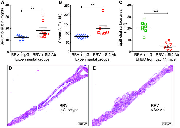 Blocking of St2 by antibodies worsens experimental biliary atresia.
Seru...