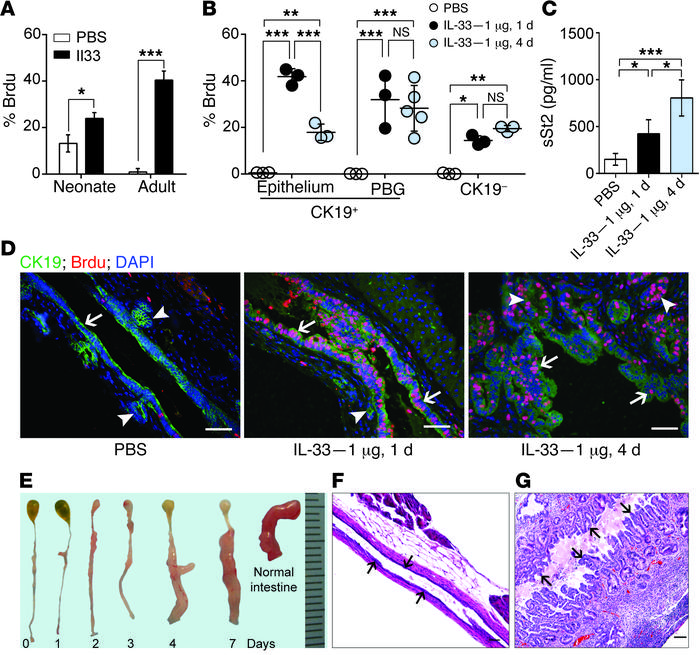 IL-33 induces cholangiocyte proliferation.
(A) Percentage of CK19+ epith...