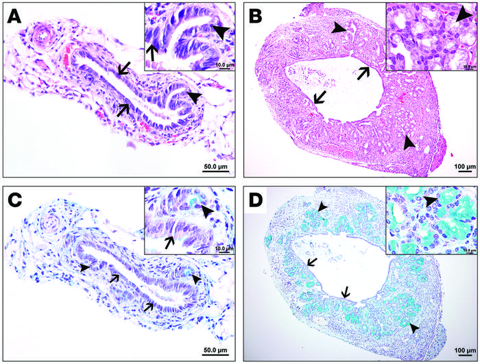 Long-term administration of IL-33 promotes epithelial metaplasia.
Cross ...