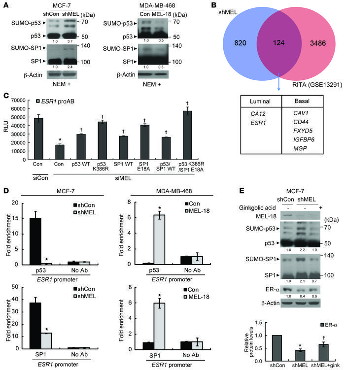 MEL-18 regulates ESR1 transcription by inhibiting the SUMOylation of the...