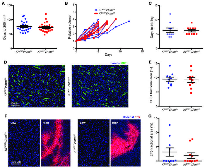 Deletion of Atm in endothelial cells does not affect tumor growth or vas...