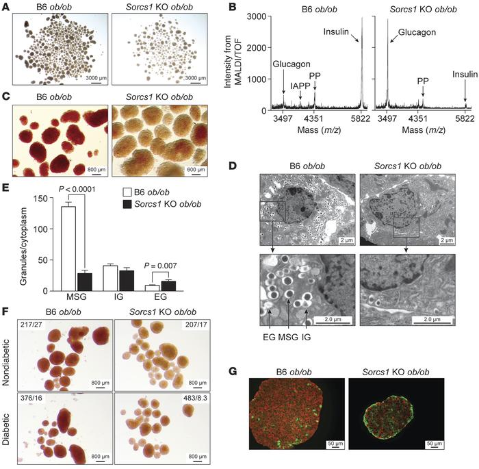 Deletion of Sorcs1 leads to severe depletion of islet insulin content an...