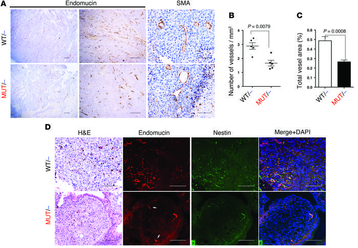 Disruption of the interaction of RAS with PI3K reduces tumor-induced ang...