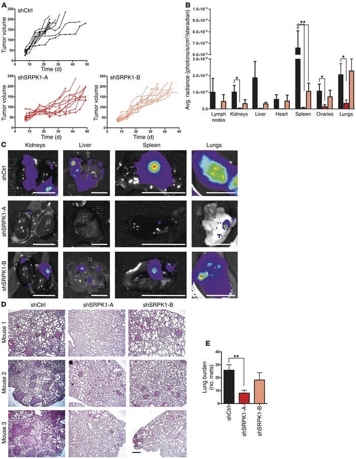 SRPK1 is required for BC metastasis in vivo.
MDA-MB-417.5 cells were tra...