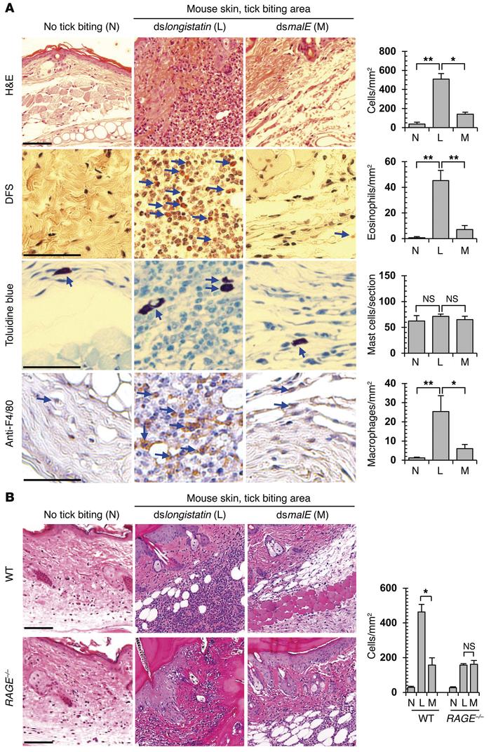 Endogenous longistatin is essential to modulating inflammation during ti...