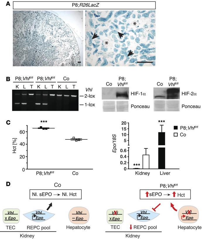 
Pax8-rtTA–mediated inactivation of Vhl induces hepatic EPO and causes p...