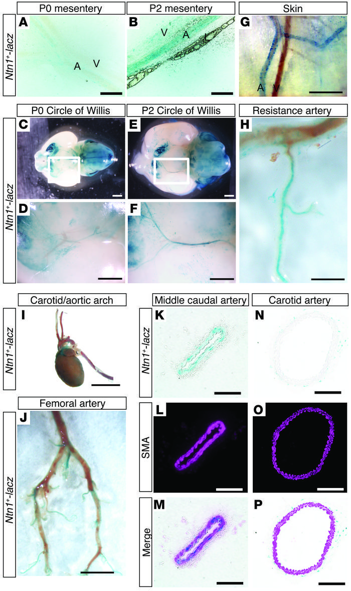 Arterial innervation correlates with netrin-1 expression.
X-gal staining...