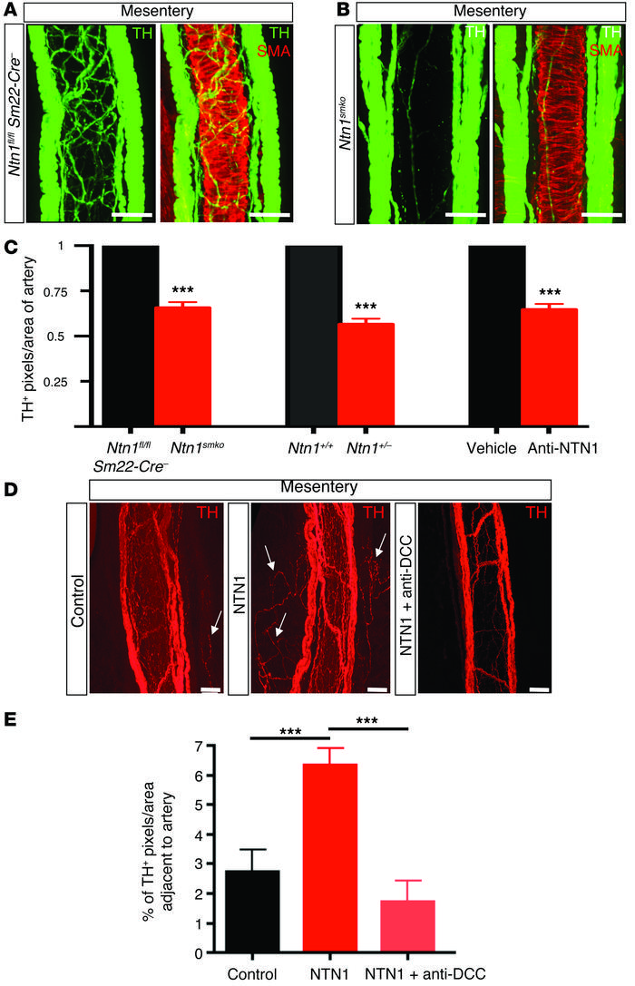Netrin-1 is required for arterial innervation.
(A and B) Confocal images...