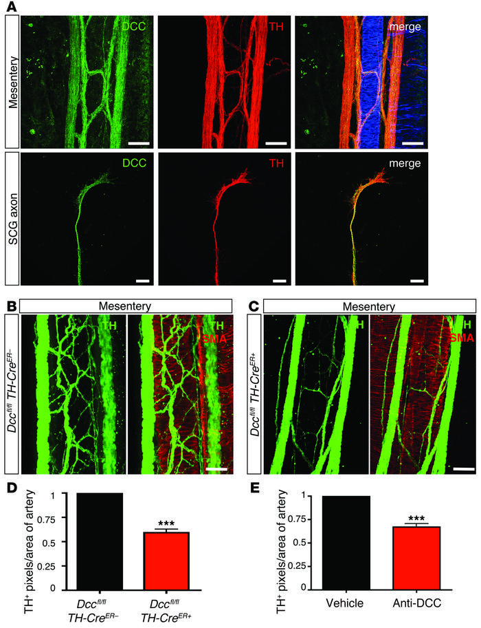 DCC mediates sympathetic innervation in response to netrin-1.
(A) Anti-D...